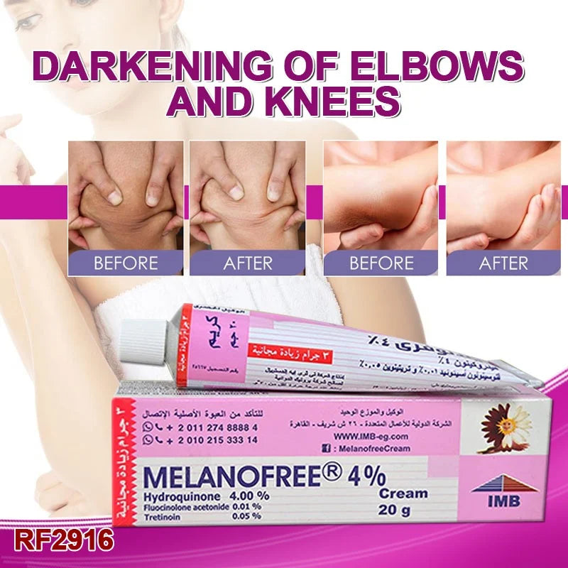 MILANOFREE CREAM (Orignal Import )